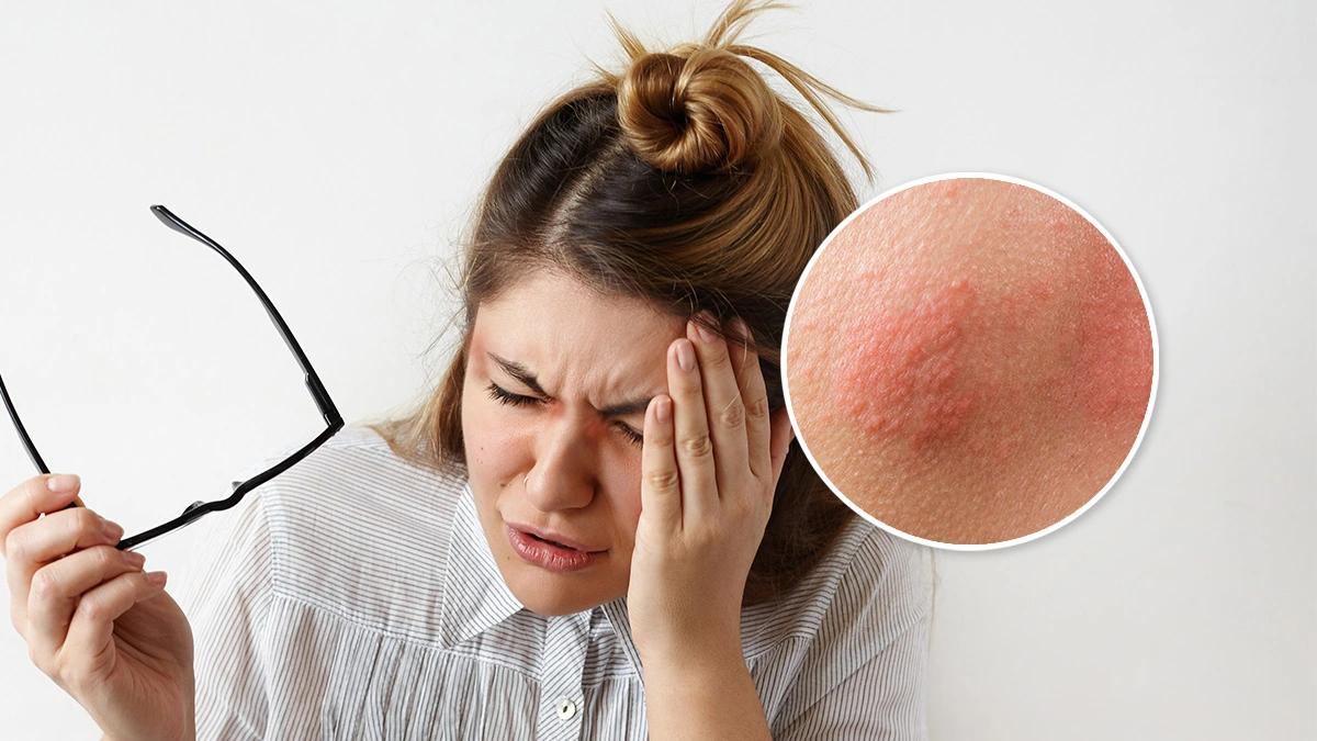 seorang wanita menderita alegi karena salah memilih kacamata